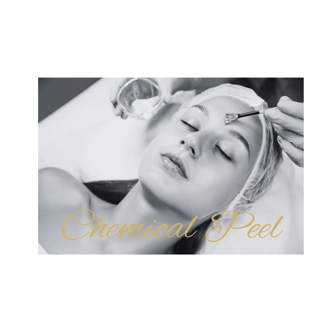 Chemical Peel